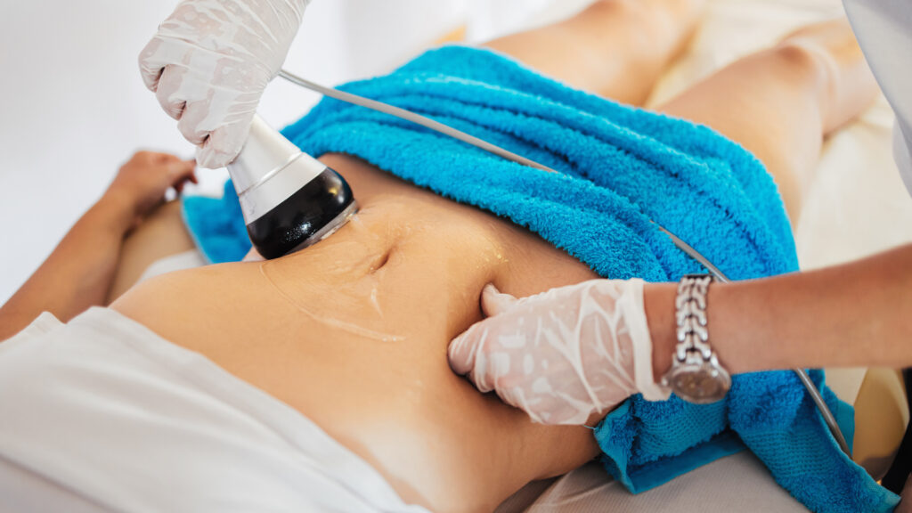 Radio Frequency for Skin Tightening & Body Sculpting
